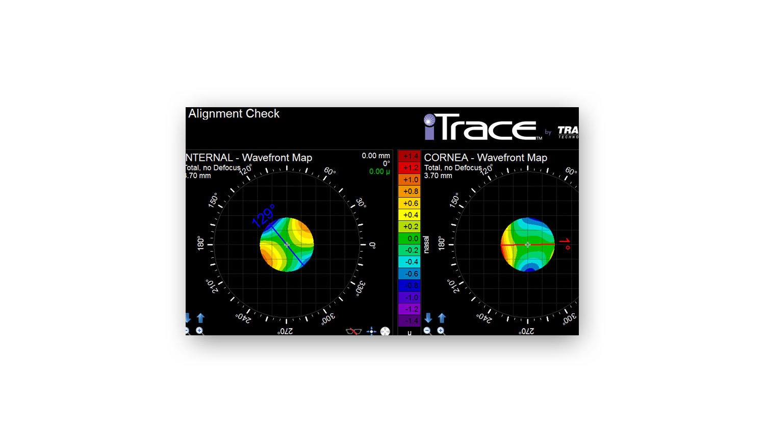 cost of itrace abberometer